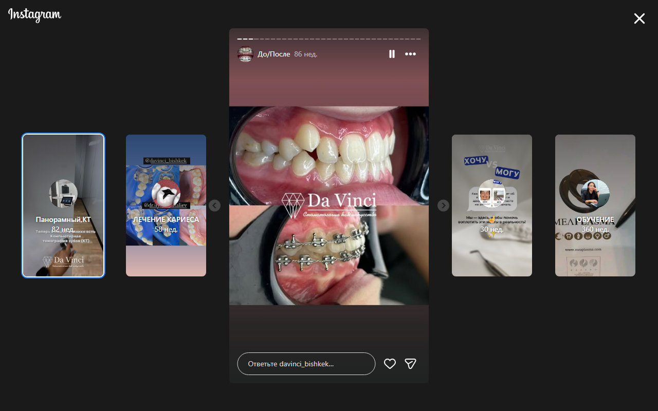 Эстетика зубов