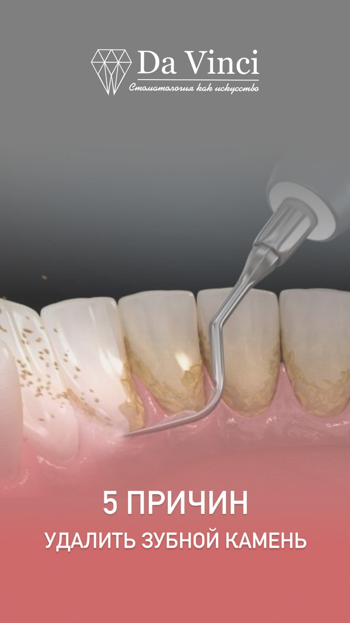 Чистка зубов