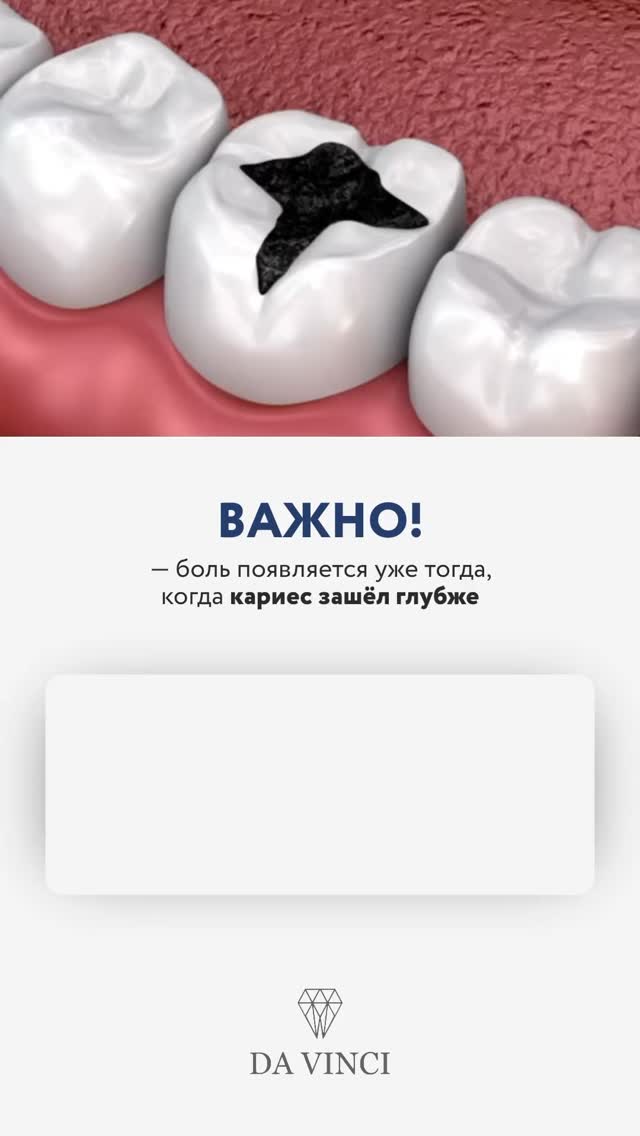 Лечение кариеса