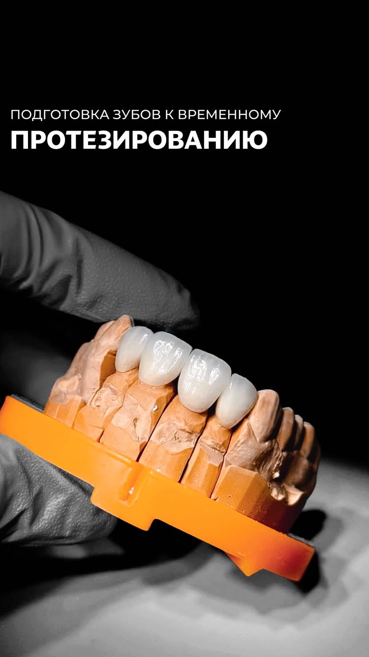 Протезирование зубов